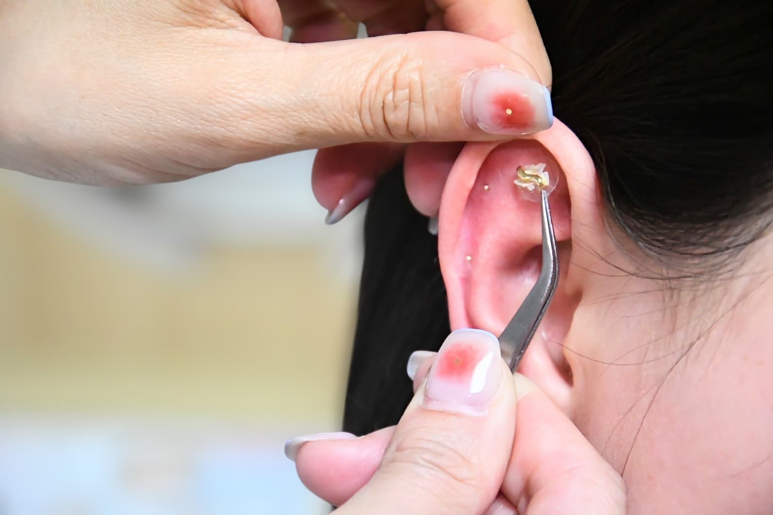 Medical Treatment 11